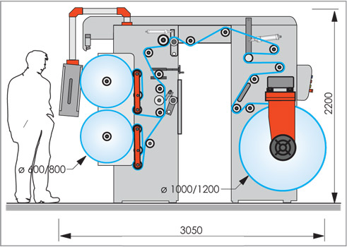 Innova Biback-HPO Diagram